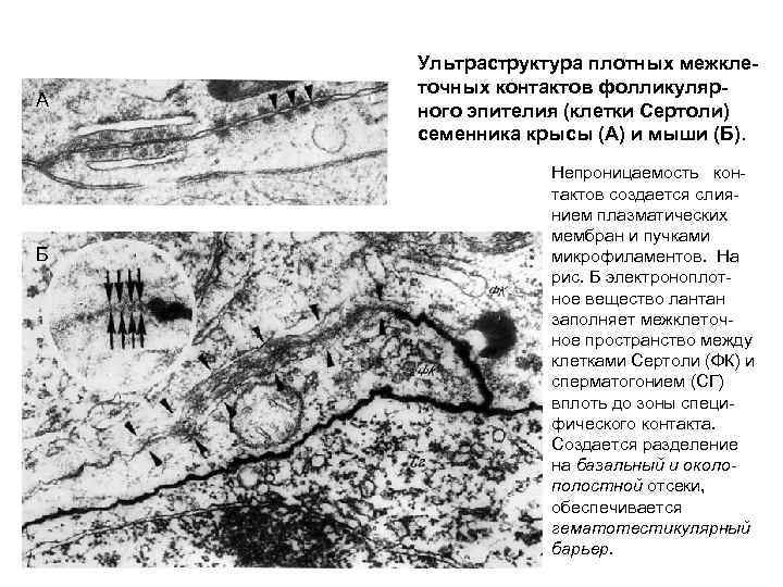 А Б Ультраструктура плотных межклеточных контактов фолликулярного эпителия (клетки Сертоли) семенника крысы (А) и