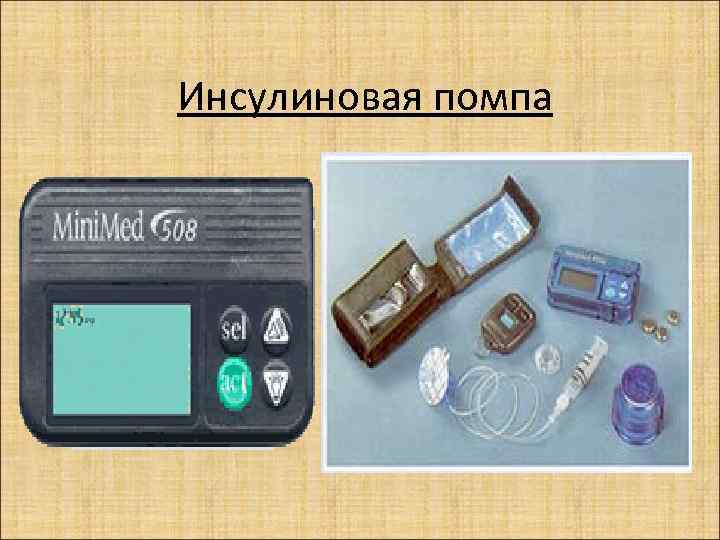 Инсулиновый шок. Инсулиновая помпа российские производства бета. Современная инсулиновая помпа строение. Первая инсулиновая помпа. АПС инсулиновая помпа.