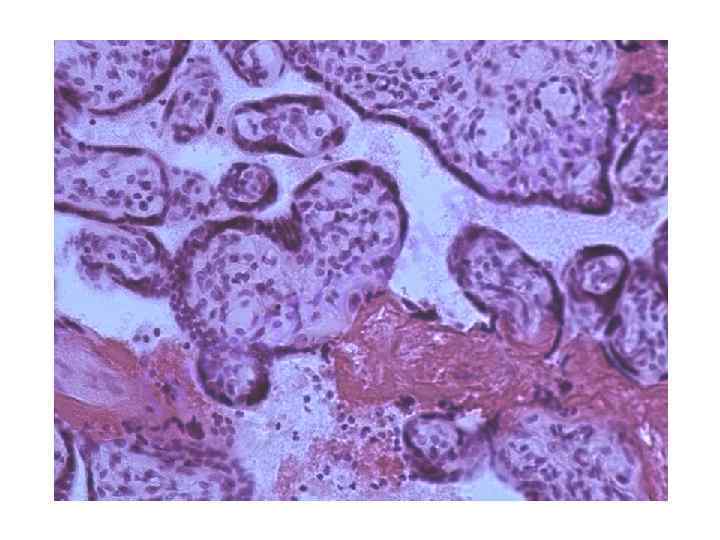 Гистология плацента презентация