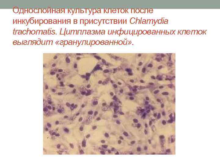 Однослойная культура клеток после инкубирования в присутствии Chlamydia trachomatis. Цитплазма инфицированных клеток выглядит «гранулированной»