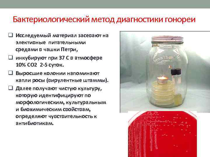 Бактериологический метод диагностики гонореи q Исследуемый материал засевают на элективные питательными средами в чашки