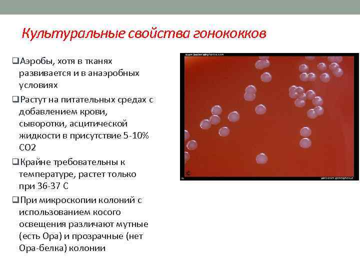 Культуральные свойства гонококков q. Аэробы, хотя в тканях развивается и в анаэробных условиях q.