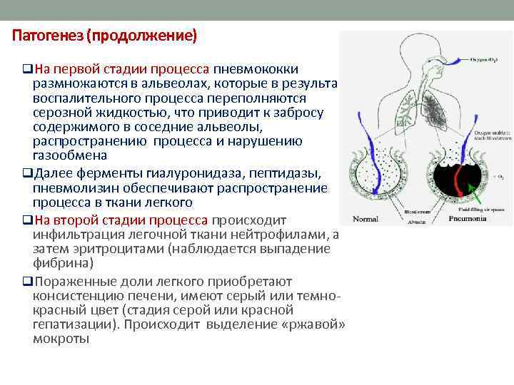  Патогенез (продолжение) q. На первой стадии процесса пневмококки размножаются в альвеолах, которые в