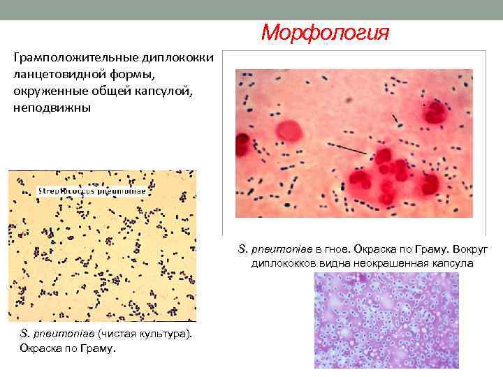 Морфология Грамположительные диплококки ланцетовидной формы, окруженные общей капсулой, неподвижны S. pneumoniae в гное. Окраска