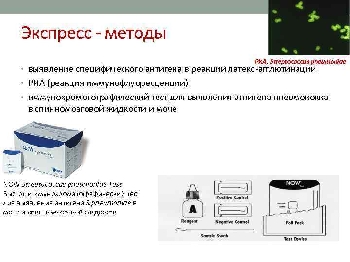 Экспресс методы РИА. Streptococcus pneumoniae • выявление специфического антигена в реакции латекс агглютинации •