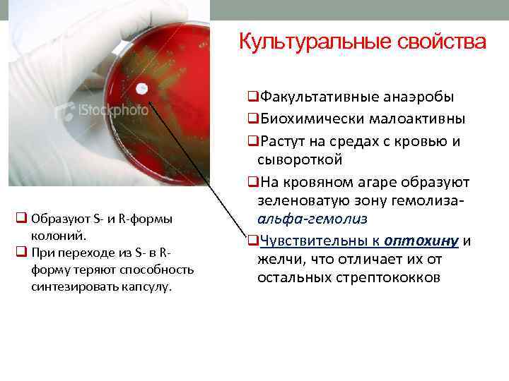 Культуральные свойства q. Факультативные анаэробы q. Биохимически малоактивны q. Растут на средах с кровью