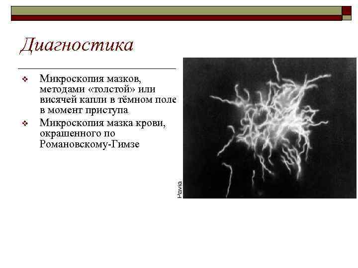 Диагностика v v Микроскопия мазков, методами «толстой» или висячей капли в тёмном поле в