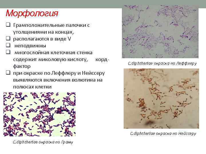 Морфология q Грамположительные палочки с утолщениями на концах, q располагаются в виде V q