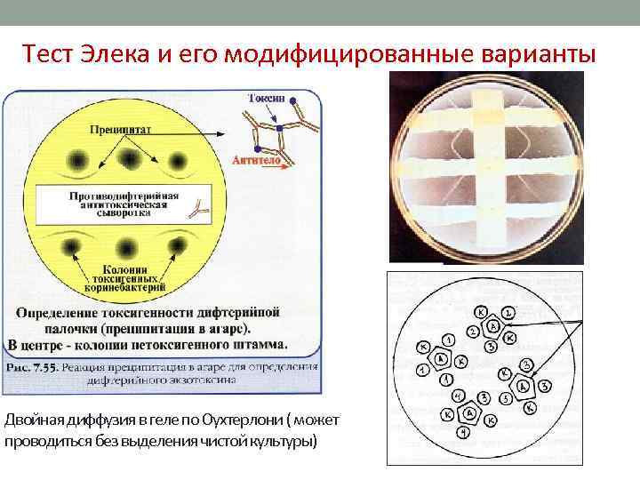 Тест Элека и его модифицированные варианты Двойная диффузия в геле по Оухтерлони ( может
