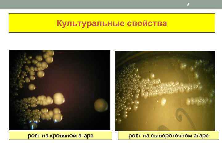 5 Культуральные свойства рост на кровяном агаре рост на сывороточном агаре 
