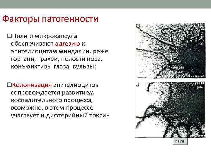 Факторы патогенности q. Пили и микрокапсула обеспечивают адгезию к эпителиоцитам миндалин, реже гортани, трахеи,