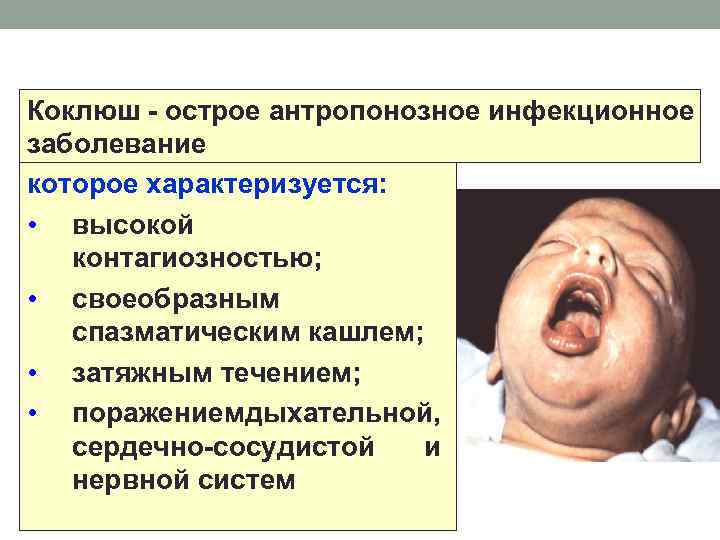 Коклюш - острое антропонозное инфекционное заболевание которое характеризуется: • высокой контагиозностью; • своеобразным спазматическим