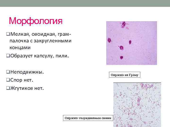 Морфология q. Мелкая, овоидная, грам- палочка с закругленными концами q. Образует капсулу, пили. q.