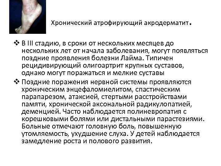 Хронический атрофирующий акродерматит . v В III стадию, в сроки от нескольких месяцев до