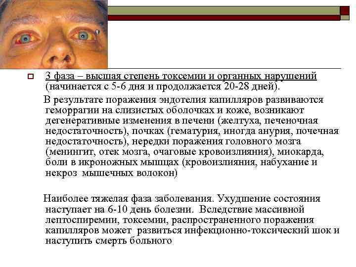o 3 фаза – высшая степень токсемии и органных нарушений (начинается с 5 -6