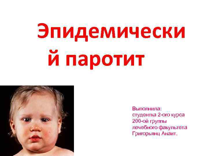 Эпидемически й паротит Выполнила: студентка 2 -ого курса 200 -ой группы лечебного факультета Григорьянц