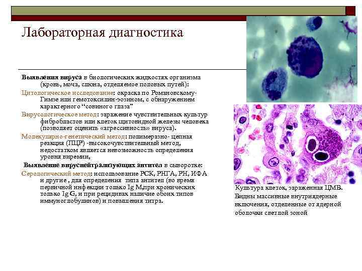 Лабораторная диагностика Выявления вируса в биологических жидкостях организма (кровь, моча, слюна, отделяемое половых путей):