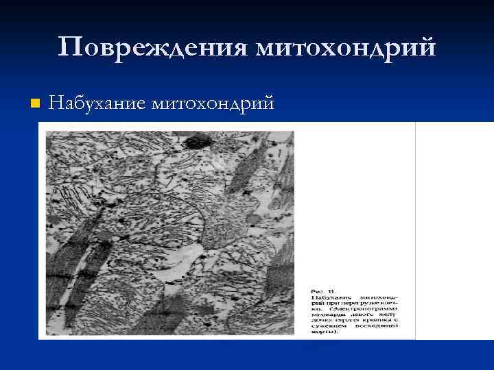 Повреждения митохондрий n Набухание митохондрий 