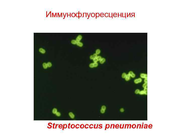 Иммунофлуоресценция Streptococcus pneumoniae 