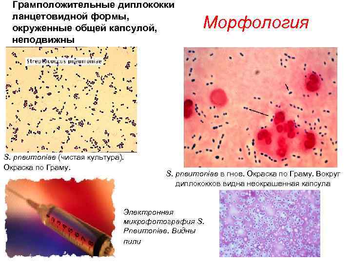  Грамположительные диплококки ланцетовидной формы, окруженные общей капсулой, Морфология неподвижны S. pneumoniae (чистая культура).