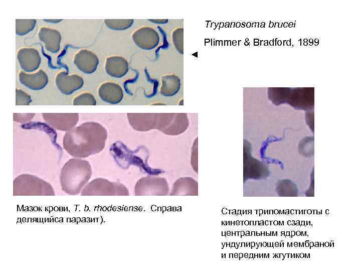  Trypanosoma brucei Plimmer & Bradford, 1899 ◄ Мазок крови, T. b. rhodesiense. Справа