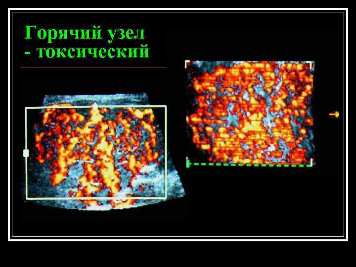 Горячий узел - токсический 