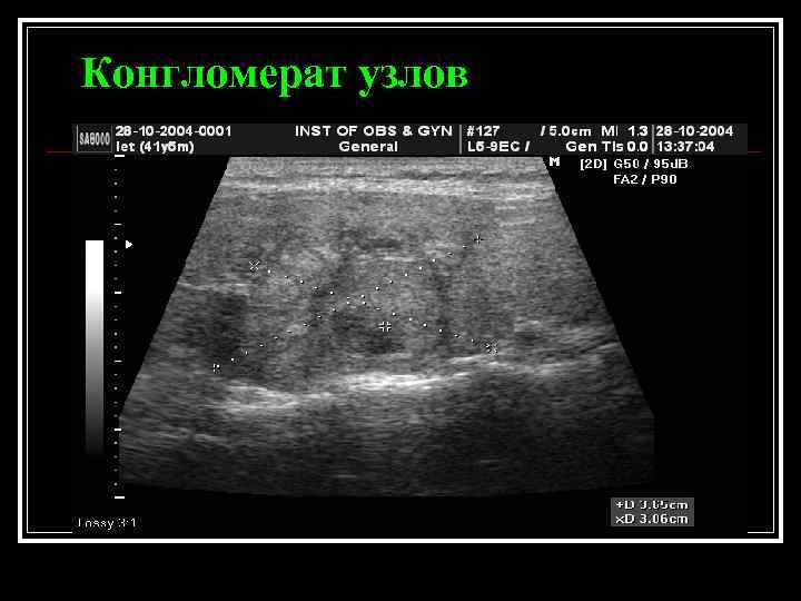 Конгломерат узлов 