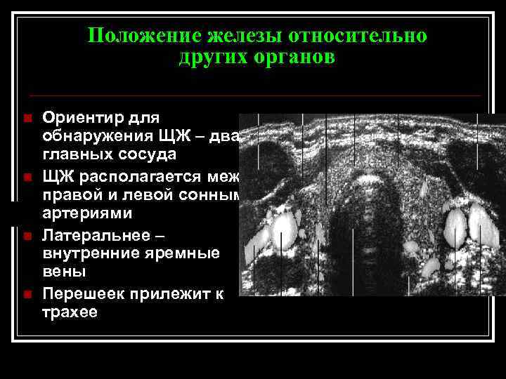 Положение железы относительно других органов n n Ориентир для обнаружения ЩЖ – два главных