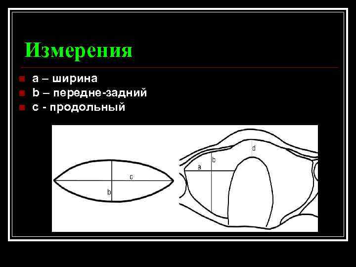 Измерения n n n a – ширина b – передне-задний c - продольный 