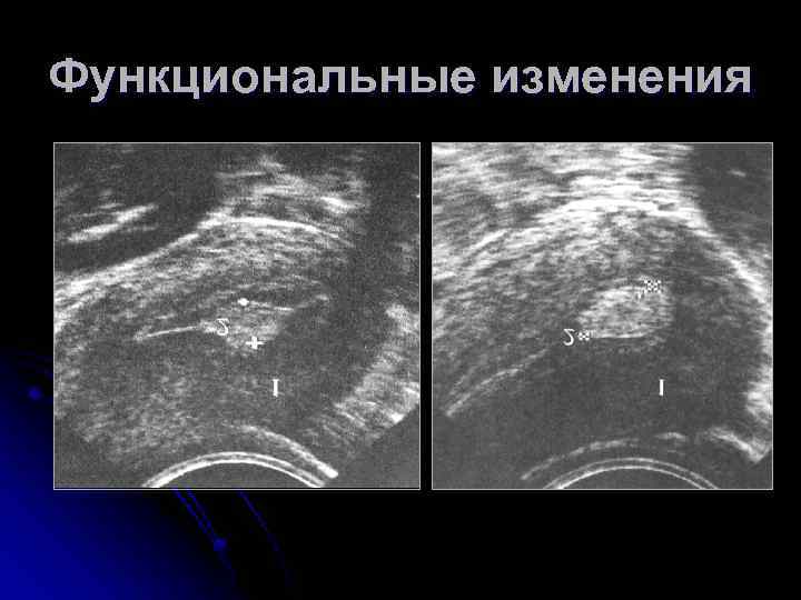 Функциональные изменения 