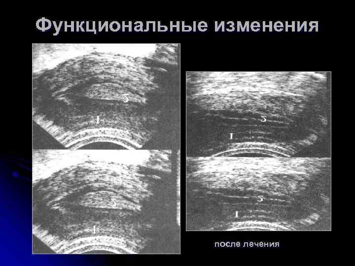 Функциональные изменения после лечения 