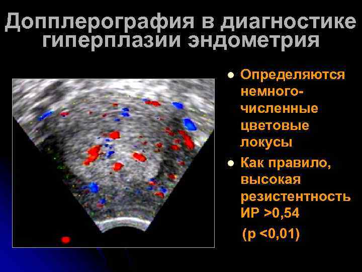 Гиперплазия эндометрия диагностика. Дюфастон при гиперплазии эндометрия схема. Реактивная гиперплазия.