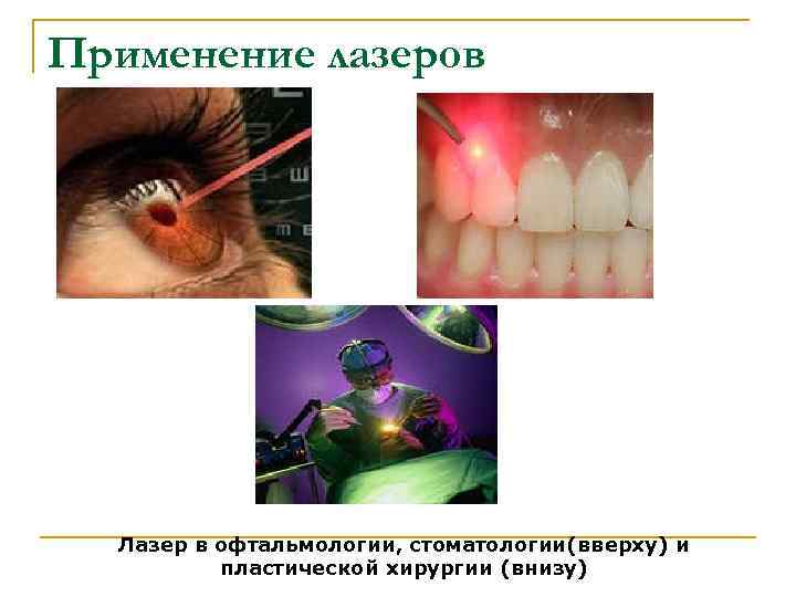 Применение лазеров Лазер в офтальмологии, стоматологии(вверху) и пластической хирургии (внизу) 