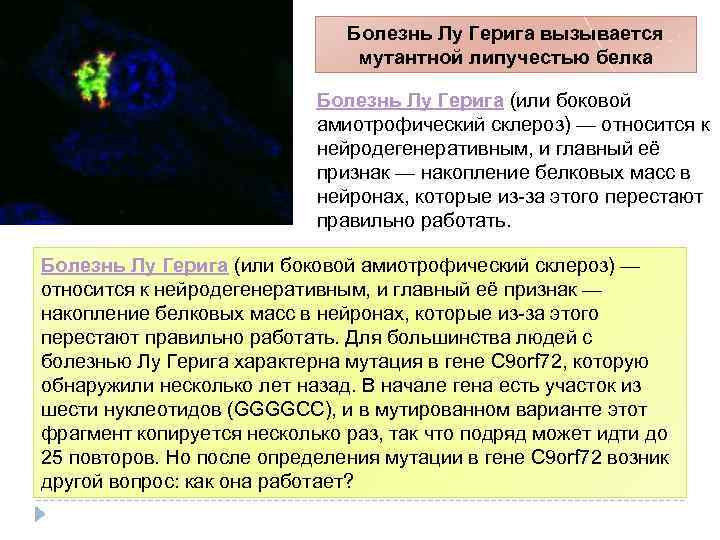 Болезнь Лу Герига вызывается мутантной липучестью белка Болезнь Лу Герига (или боковой амиотрофический склероз)