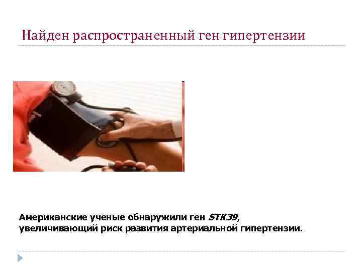 Найден распространенный ген гипертензии Американские ученые обнаружили ген STK 39, увеличивающий риск развития артериальной