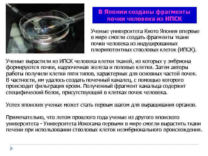В Японии созданы фрагменты почки человека из ИПСК Ученые университета Киото Япония впервые в