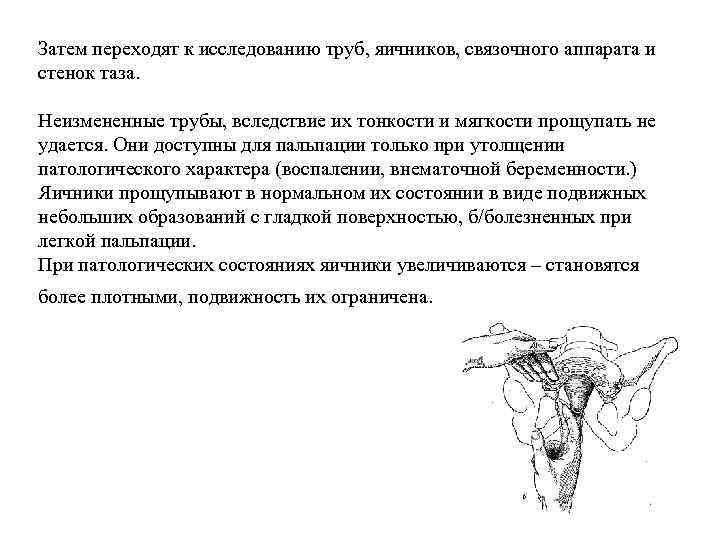 Затем переходят к исследованию труб, яичников, связочного аппарата и стенок таза. Неизмененные трубы, вследствие