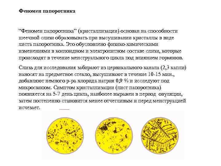Феномен папоротника “Феномен папоротника” (кристаллизации) основан на способности шеечной слизи образовывать при высушивании кристаллы