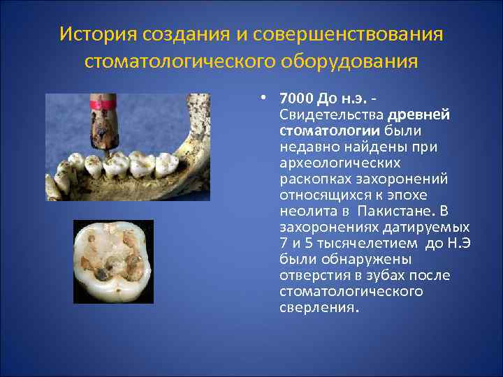 История создания и совершенствования стоматологического оборудования • 7000 До н. э. Свидетельства древней стоматологии