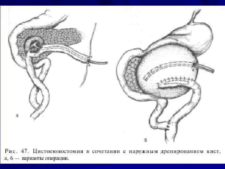 Курс факультетской хирургии в рисунках таблицах и схемах