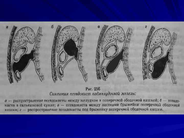 Курс факультетской хирургии в рисунках таблицах и схемах