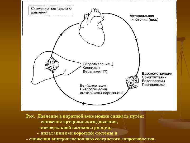 Рис. Давление в воротной вене можно снижать путём: снижения артериального давления, висцеральной вазоконстрикции, дилатации