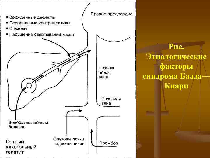 Портальная гипертензия презентация факультетская хирургия