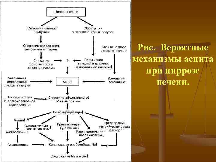 Рис. Вероятные механизмы асцита при циррозе печени. 