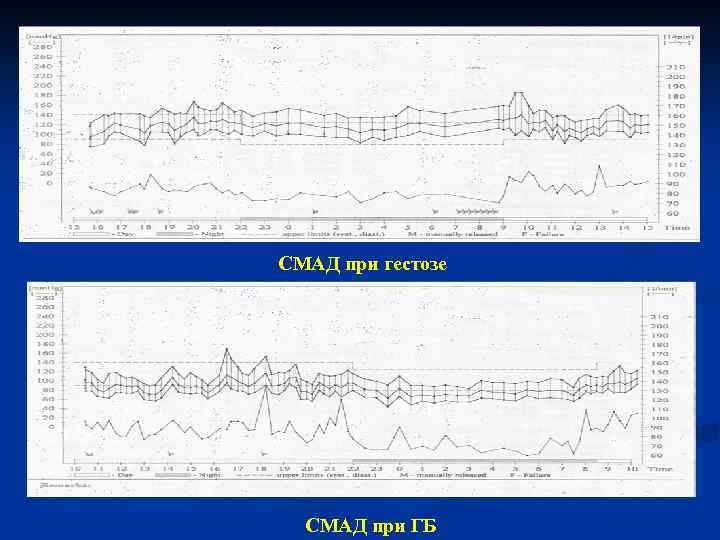 СМАД при гестозе СМАД при ГБ 