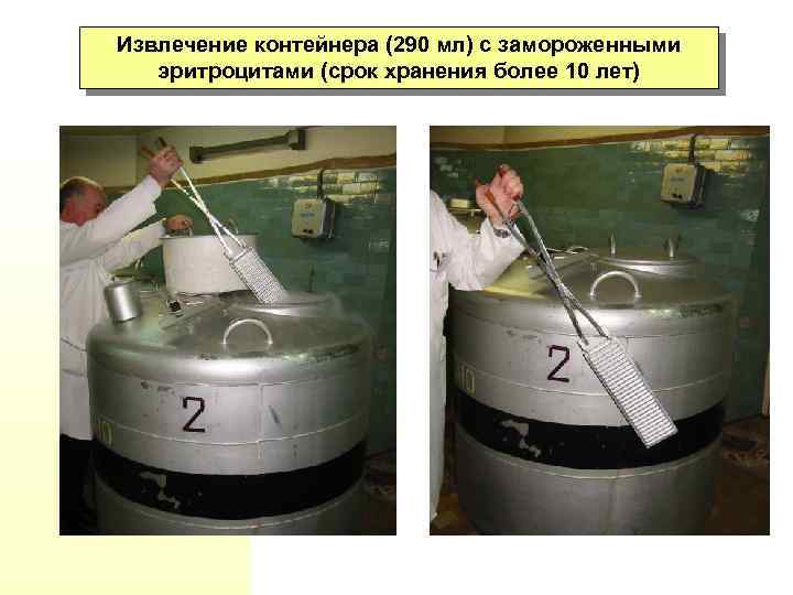 Извлечение контейнера (290 мл) с замороженными эритроцитами (срок хранения более 10 лет) 