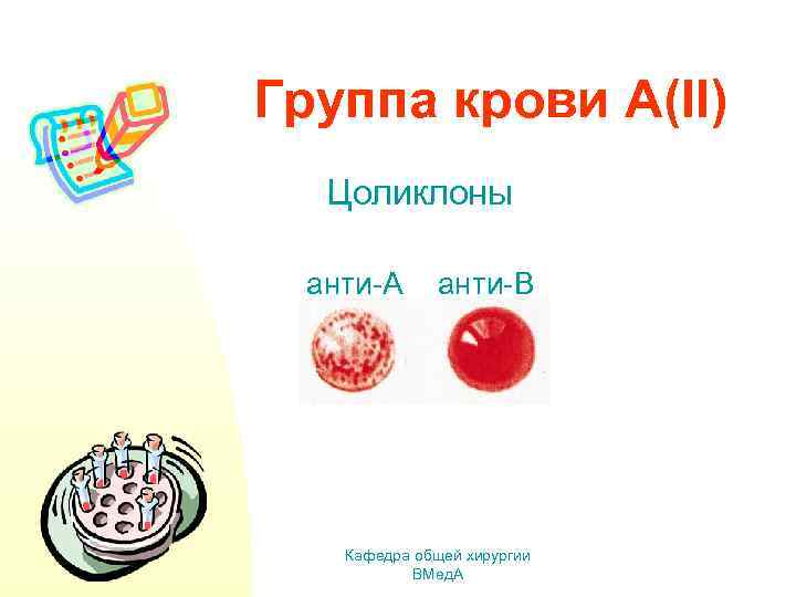 Группа крови А(II) Цоликлоны анти-А анти-В Кафедра общей хирургии ВМед. А 