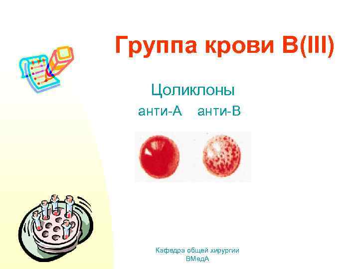 Группа крови В(III) Цоликлоны анти-А анти-В Кафедра общей хирургии ВМед. А 