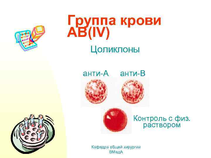 Группа крови АВ(IV) Цоликлоны анти-А анти-В Контроль с физ. раствором Кафедра общей хирургии ВМед.
