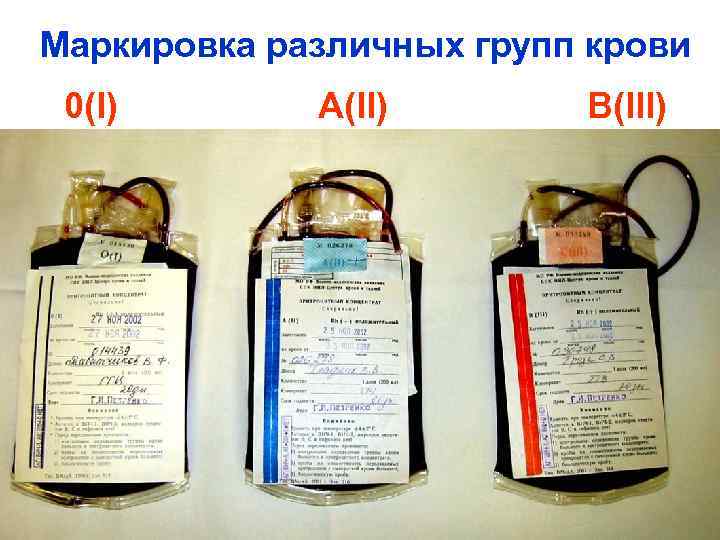 Маркировка различных групп крови 0(I) A(II) B(III) 